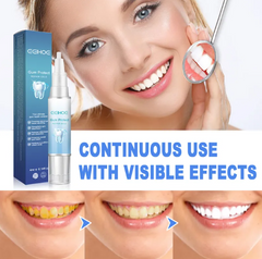 teeth-repair-gel