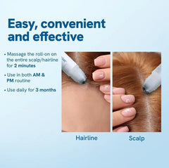 hair-ball-essence-rosemary-growth-oil